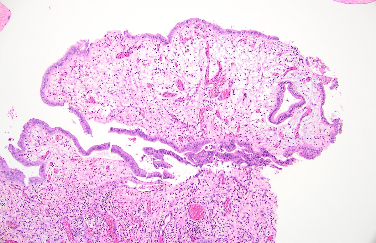 Diane Brackett, MD tweet media