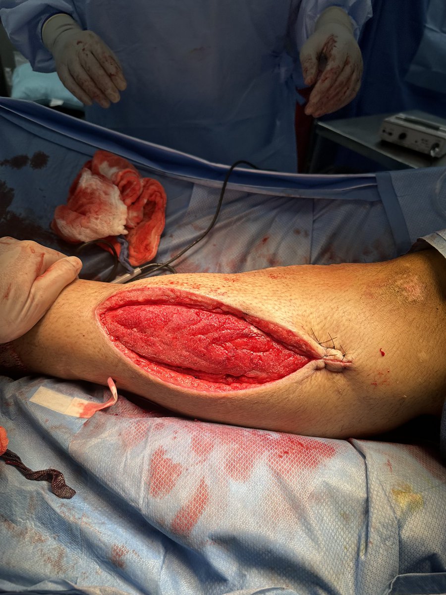 frank arko tweet media