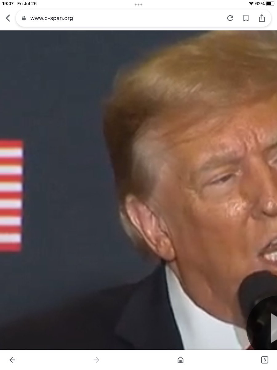 findkp's tweet photo. @AesPolitics1 If you check a 2023 speech, he had the same bump on his right ear as part of normal ear anatomy. The present bump today has been his since birth. It’s not a healed injury. https://t.co/1UozrdONKt