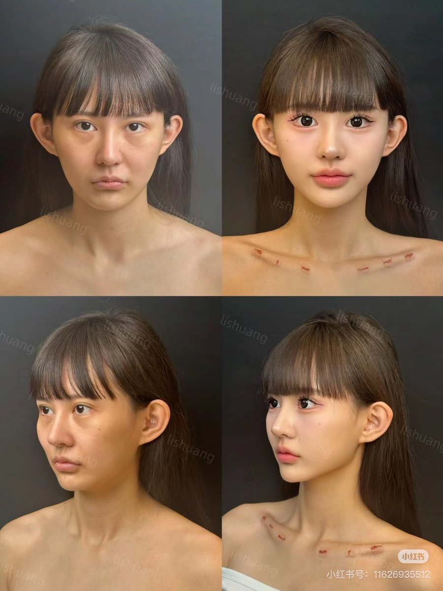 なるちゃん@垢抜け研究👼🏻 tweet media