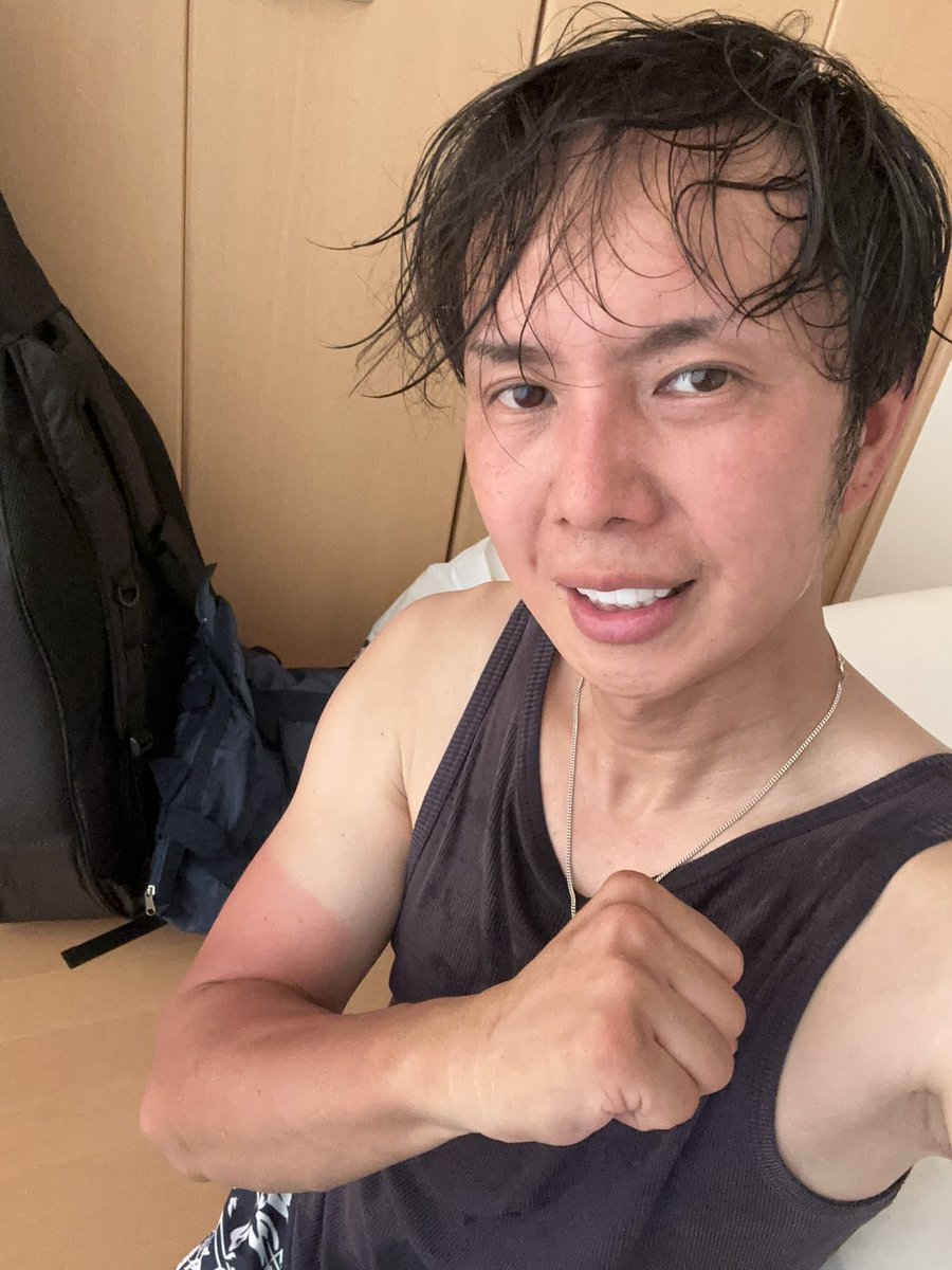 38miyatan's tweet image. 半日、日焼け止め無しで半袖で
ハーレー🛵乗り回すと
腕が、こうなります🤣www
日焼け止めの大切さが痛いほど分かる腕
ヒリヒリする〜💦⚡️😣
@38miyatan 
#HarleyDavidson 
#バイク
#ROUTE65 
#みやたん
#日焼け