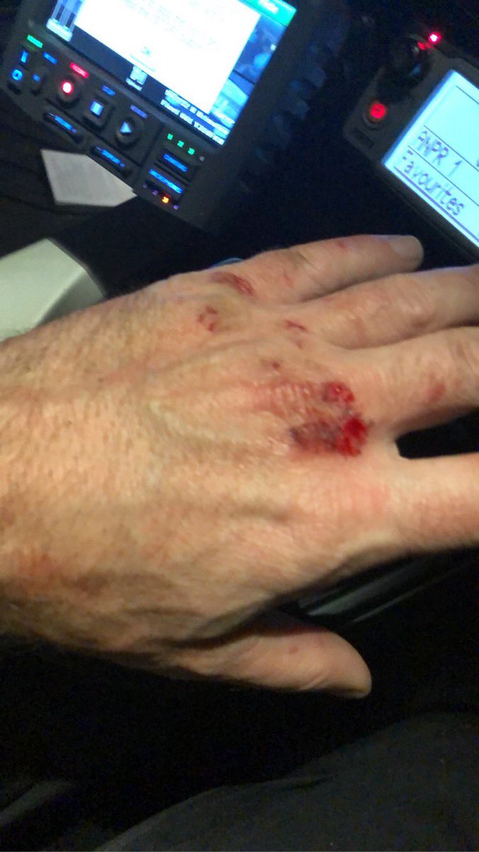 brimmers tweet media