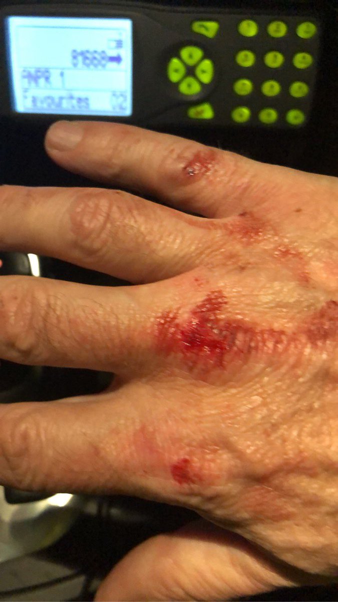 brimmers tweet media