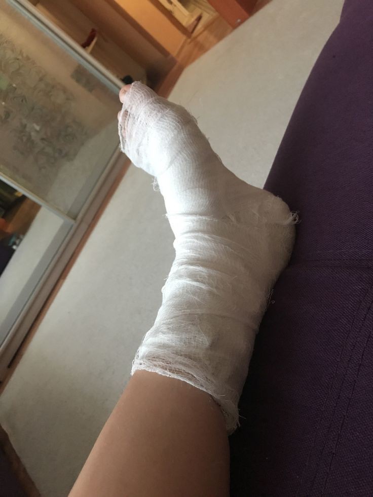0birzeyna's tweet photo. küçük bir kaza dan dolayı buralarda değilim 🤦🏻 https://t.co/oVN9jY6LBY