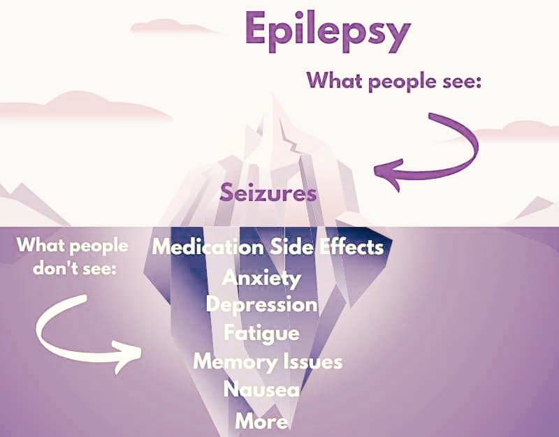 I don't even think they see all seizures to be honest