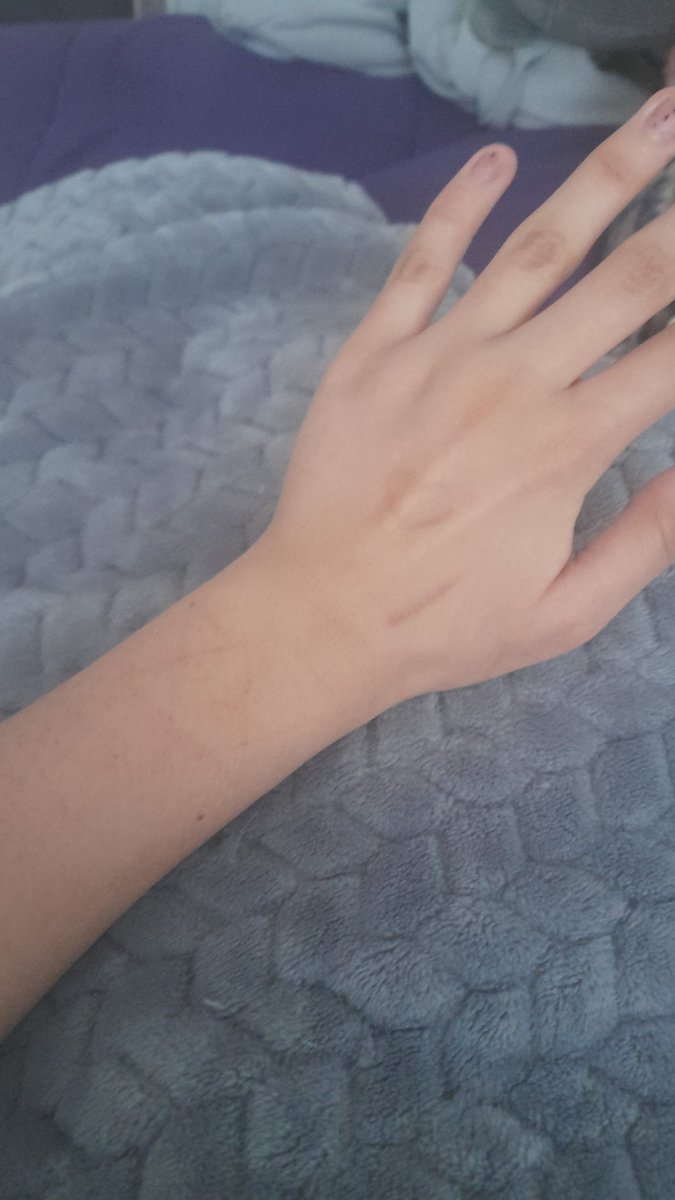 Pasen tips para adelgazar brazo porfa