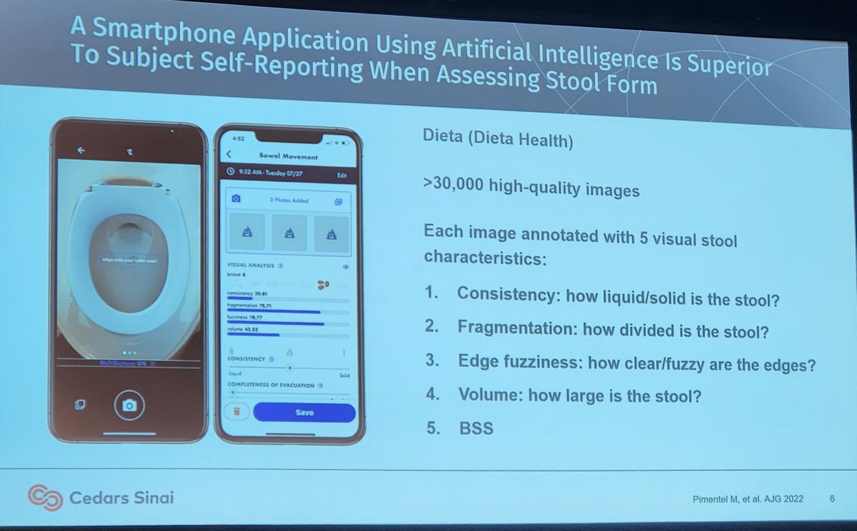 Great talk by <a href="/BiancaWChangMD/">Bianca Chang</a> at <a href="/ANMSociety/">ANMS</a> conference in Baltimore on how AI assessment of stool images is taking away the subjectivity of stool form quantification. Replacing subjective outcomes with objective ones is the only way forward to develop precision therapeutics in