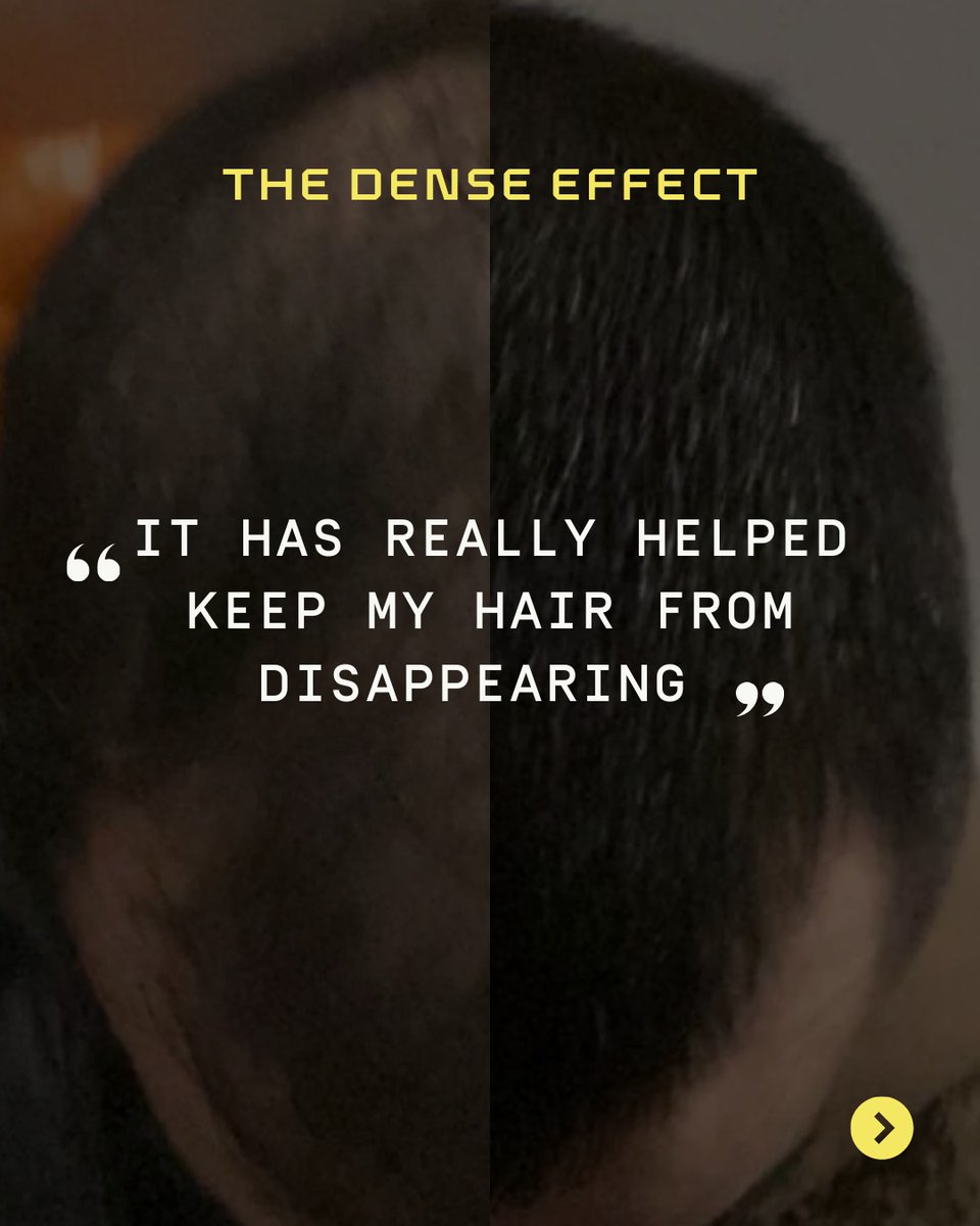 Dense Hair Experts tweet media