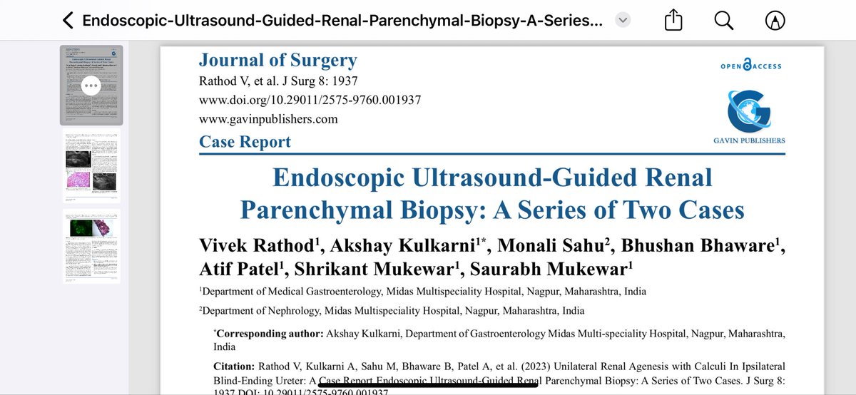 saurabhmukewar's tweet image. EUS guided Kidney Biopsy. Expanding the role of EUS..