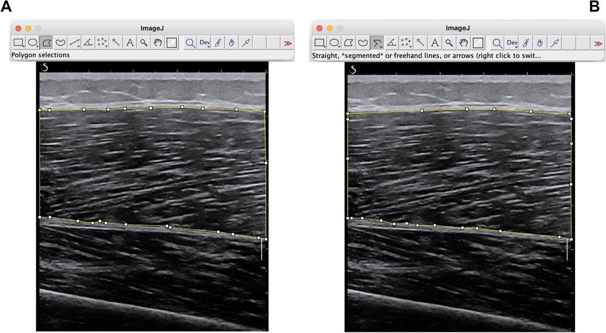 Journal Ultrasound tweet media