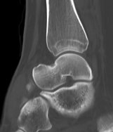 UW MSK Imaging & Intervention tweet media