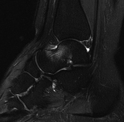 UW MSK Imaging & Intervention tweet media