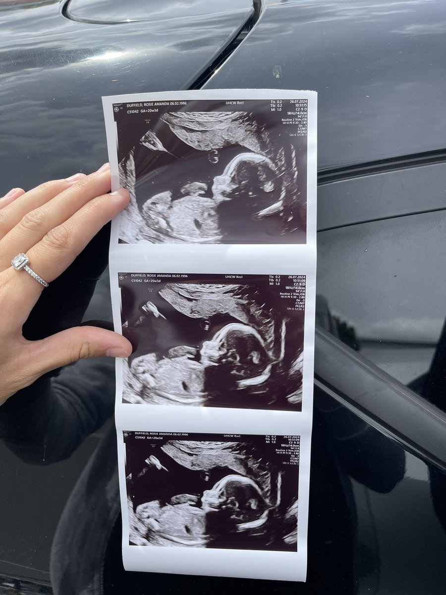 Rosie🖤 tweet media