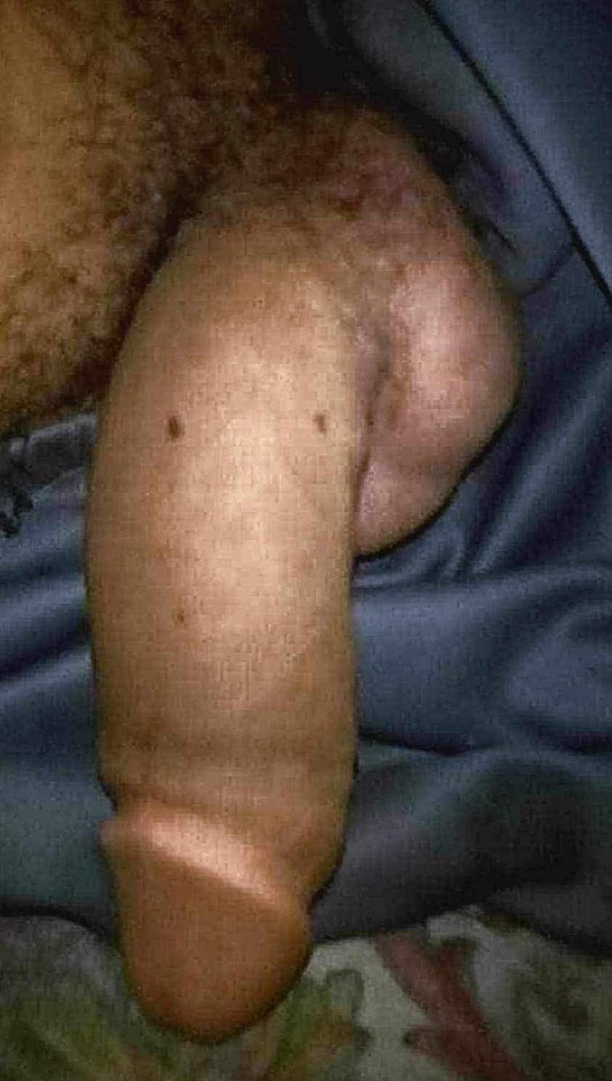 انا عمري ١٥سنه وابحت عن سالب