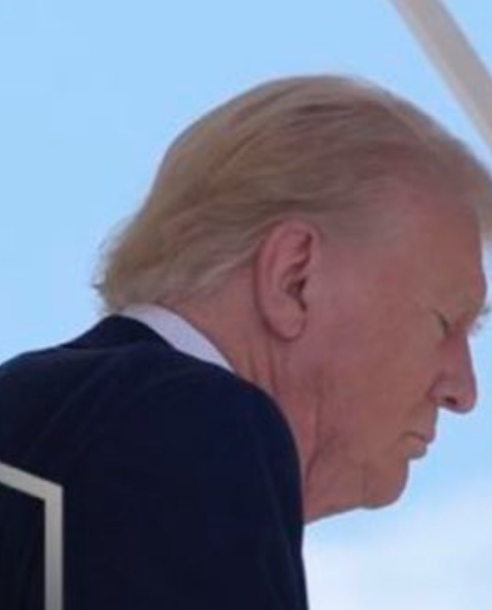 Jack Hopkins (@thejackhopkins) on Twitter photo The FBI has some answering to do. Weโve seen a close up picture of Trumpโs right ear that was posted by .<a href="/PeteSouza/">Pete Souza</a> and presumably taken by the Associated Press.
The assassination attempt was just 14 days ago. Trump is 78 years old. 78 year old human beings heal far more The FBI has some answering to do. Weโve seen a close up picture of Trumpโs right ear that was posted by .<a href="/PeteSouza/">Pete Souza</a> and presumably taken by the Associated Press.
The assassination attempt was just 14 days ago. Trump is 78 years old. 78 year old human beings heal far more