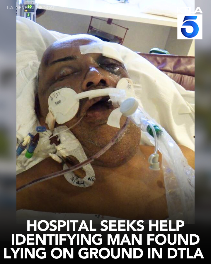 KTLA's tweet photo. A local hospital needs help identifying a patient found lying on the ground in downtown Los Angeles.
Details: https://t.co/djc9QgIy7i https://t.co/XdqflBPozt