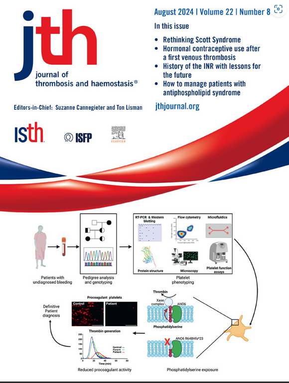 JTH (@jthjournal) on Twitter photo New #coverArt #August1
<a href="/sam_310/">Sam Montague</a> et al <a href="/neilvmorgan/">Prof Neil Morgan 💙</a> show comprehensive report of a patient with Scott syndrome with novel frameshift variant in AN06
⏩ no #platelets PS exposure
📉 thrombin generation, explaining the bleeding phenotype.
sciencedirect.com/science/articl… New #coverArt #August1
<a href="/sam_310/">Sam Montague</a> et al <a href="/neilvmorgan/">Prof Neil Morgan 💙</a> show comprehensive report of a patient with Scott syndrome with novel frameshift variant in AN06
⏩ no #platelets PS exposure
📉 thrombin generation, explaining the bleeding phenotype.
sciencedirect.com/science/articl…