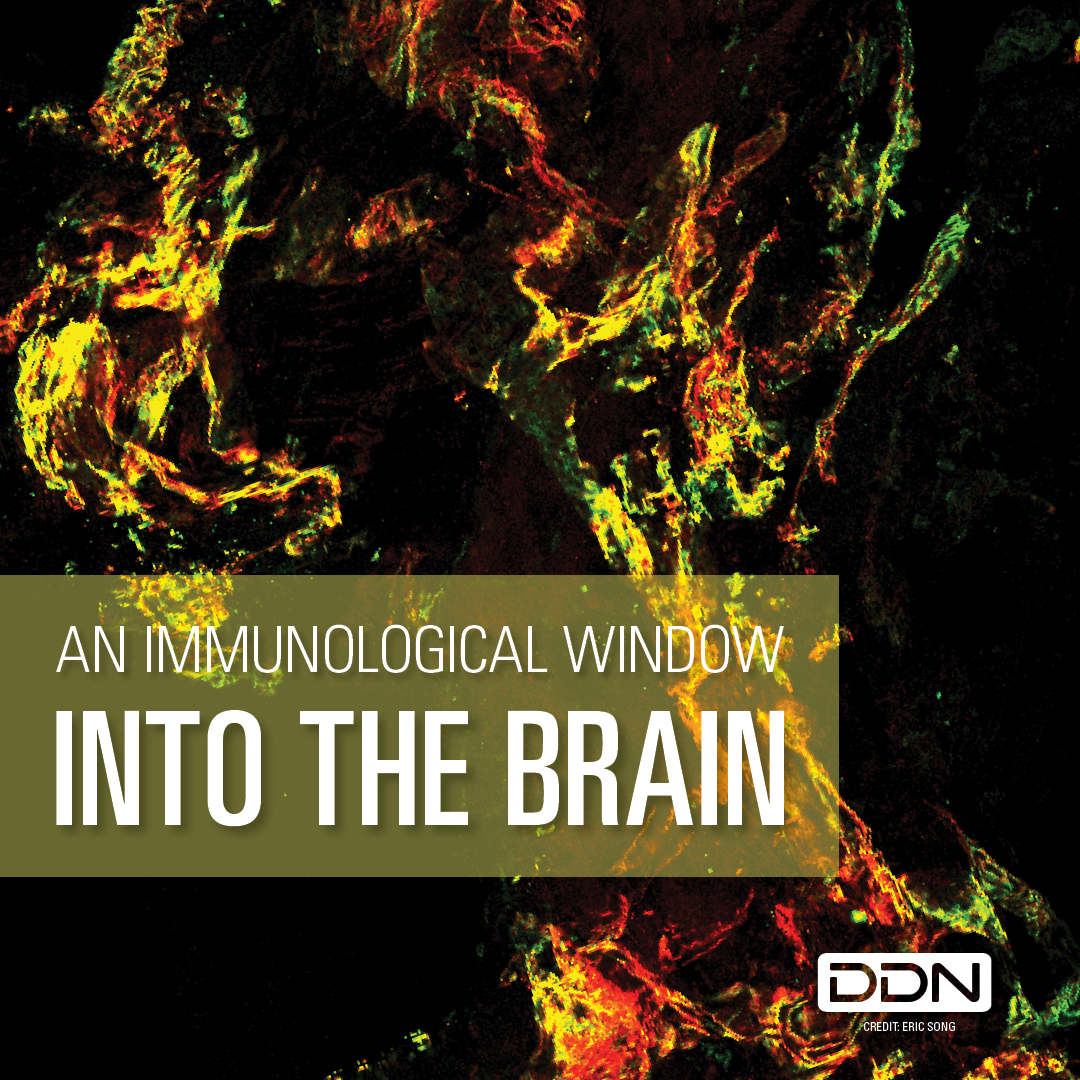 Drug Discovery News (@drugdiscovnews) on Twitter photo Researchers led by <a href="/ericsongg/">eric hoyeon song</a> <a href="/YaleMed/">Yale School of Medicine</a> uncovered a never before seen immunological connection between the eye and brain that confers shared immunity to pathogens.
<a href="/allisonpwhitten/">Allison Whitten, PhD</a> reports on the new findings.
Learn more about our Image of the Month: ow.ly/nbFJ50SLlH0 Researchers led by <a href="/ericsongg/">eric hoyeon song</a> <a href="/YaleMed/">Yale School of Medicine</a> uncovered a never before seen immunological connection between the eye and brain that confers shared immunity to pathogens.
<a href="/allisonpwhitten/">Allison Whitten, PhD</a> reports on the new findings.
Learn more about our Image of the Month: ow.ly/nbFJ50SLlH0