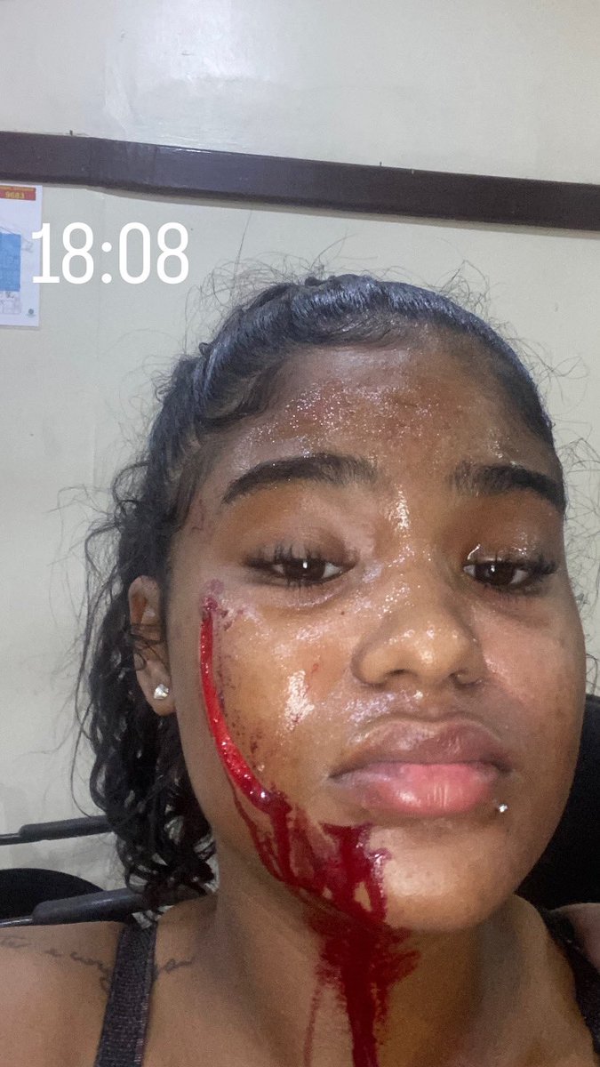 eu_mily44's tweet photo. tinha aproximadamente 8L de óleo quente dentro do tacho!
Ela vai pagar, quem me conhece sabe que eu sou tranquilona não mexo com ninguém, é só trabalho e casa e vim uma filha da puta dessas com ciúmes de pika fazer uma covardia dessas nem pra vim na mão, COVARDE 😡😡😭😭😭😭😭💔 https://t.co/iqSyGnCzsT
