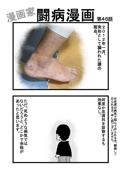 第46話 ※最初のページに多少グロテスクな写真がありますのでご注意下さい。
#漫画家闘病漫画 #骨巨細胞腫 