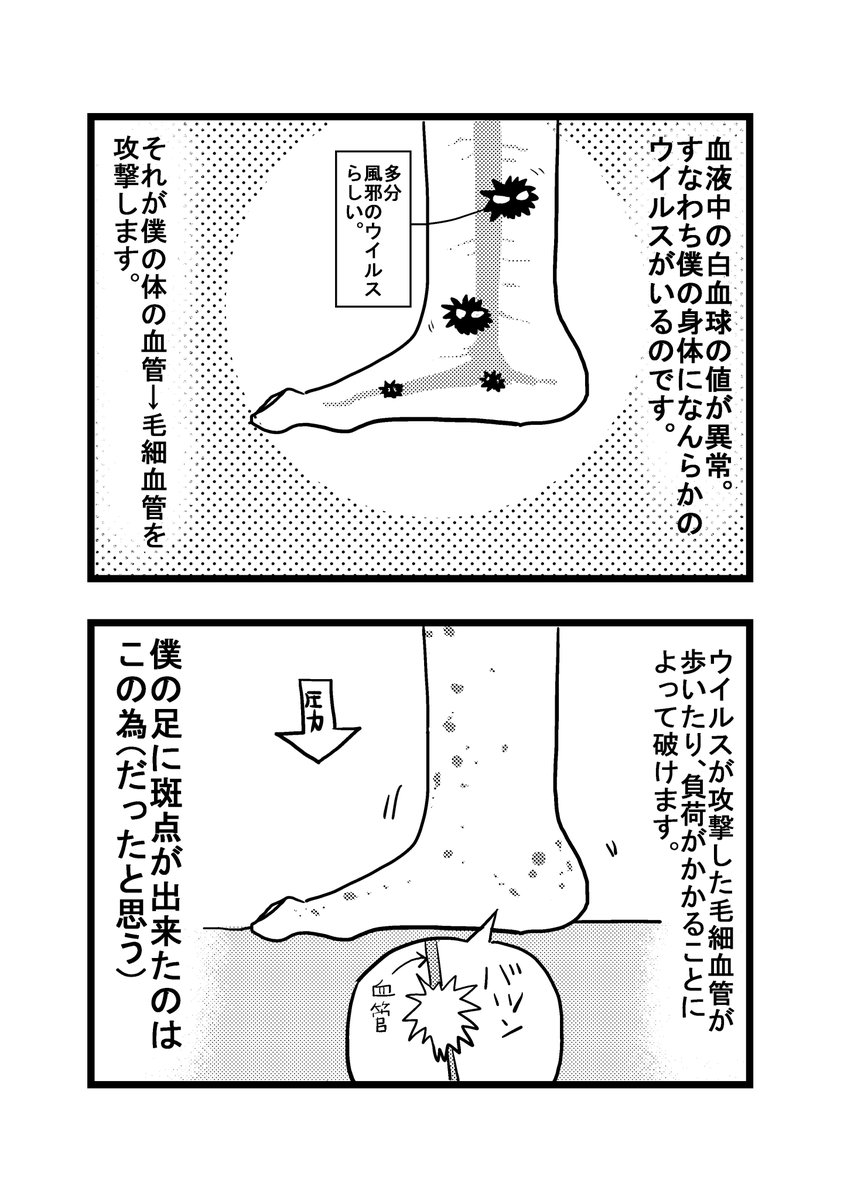 第48話
#漫画家闘病漫画 #骨巨細胞腫 