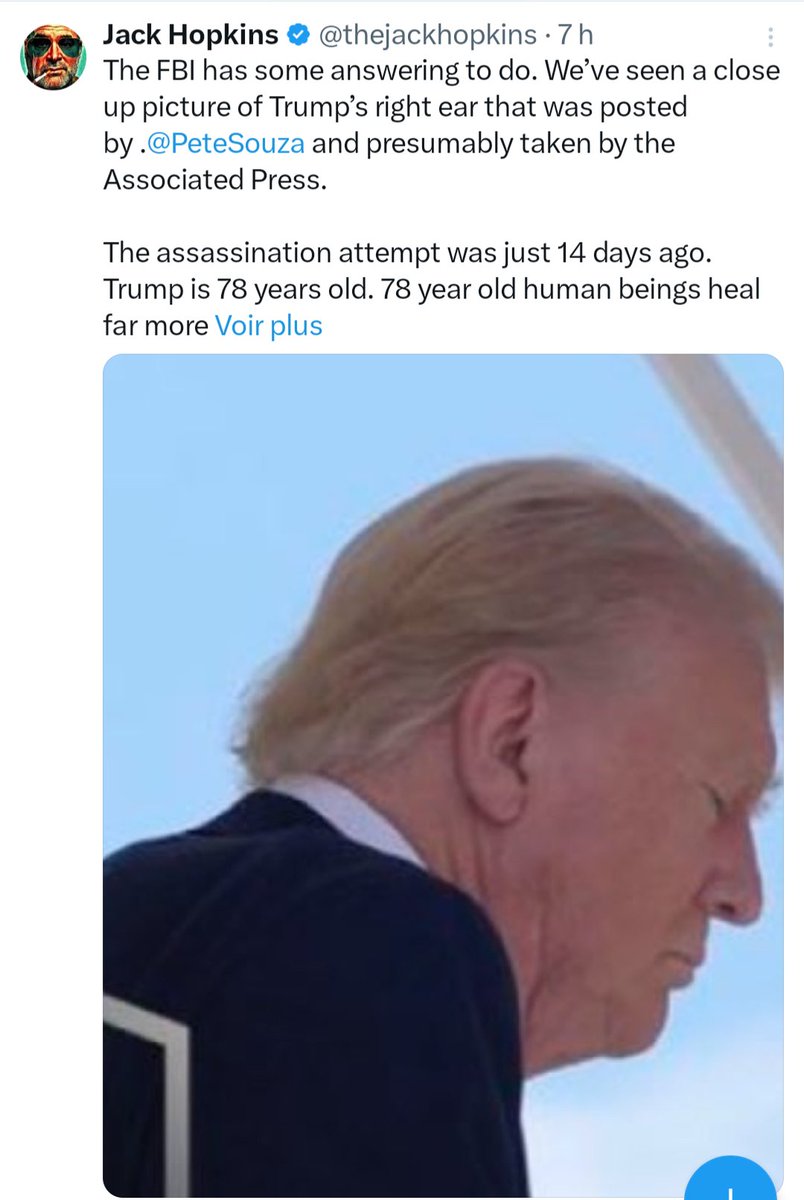 Nain_Portekoi's tweet photo. Cette photo de l'oreille de Donald Trump totalement intacte à peine deux semaines après qu'il ait été blessé suscite beaucoup de commentaires et d'interrogations.
Il y a pourtant une explication toute simple : Trump est mort et a été remplacé par un acteur. https://t.co/XzKVTkm6Cq
