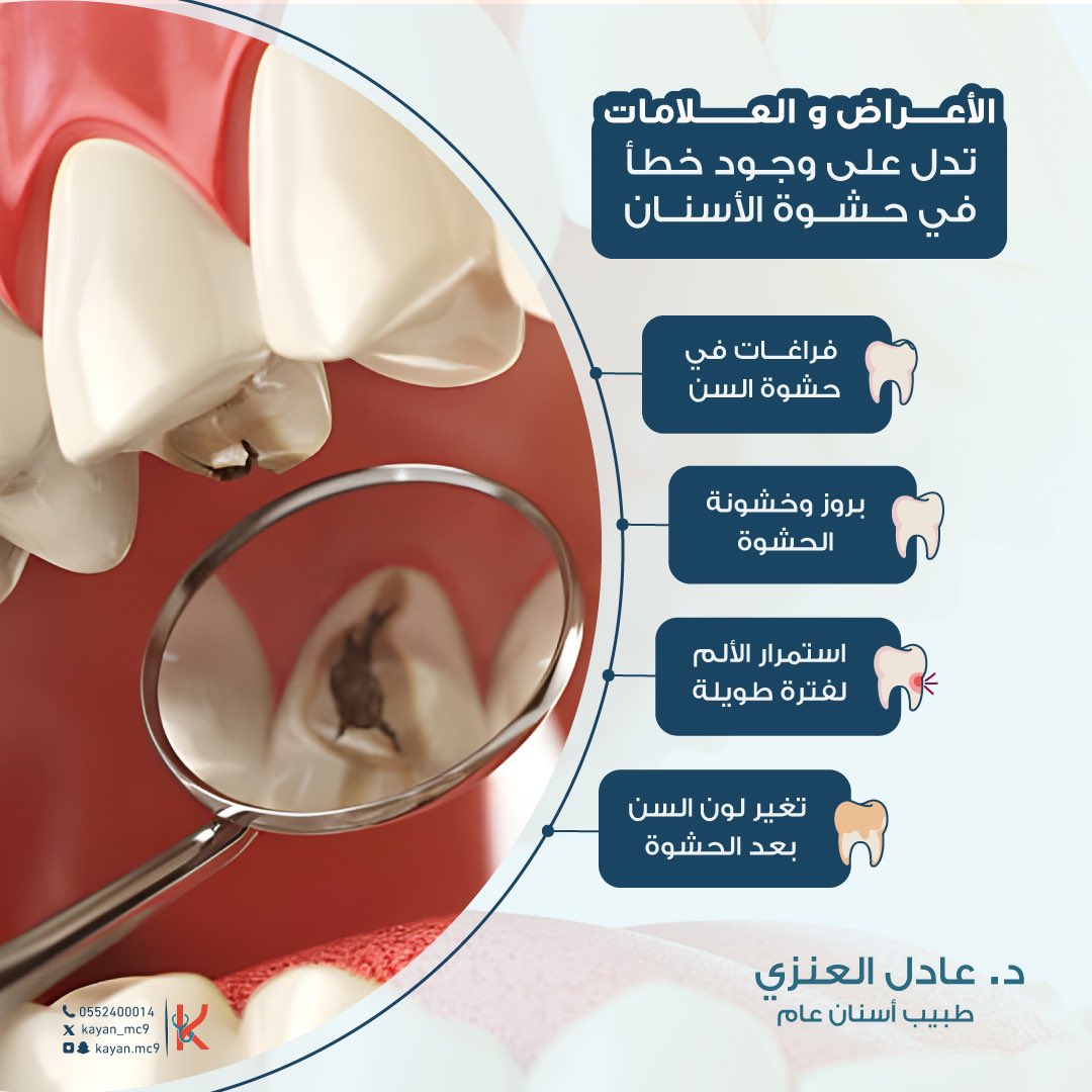 Kayan_mc9's tweet photo. كيف تعرف اذا كان تركيب الحشوات سليم أم لا؟ 🦷
فقرة تثقيفية مع طبيب الأسنان د. عادل العنزي 

للحجز والاستفسار:
0552400014

#مجمع_كيان_المدينة_الطبي #المدينة_المنورة #المدينه_المنورة #المدينه #المدينة https://t.co/3JE5rjAgoy