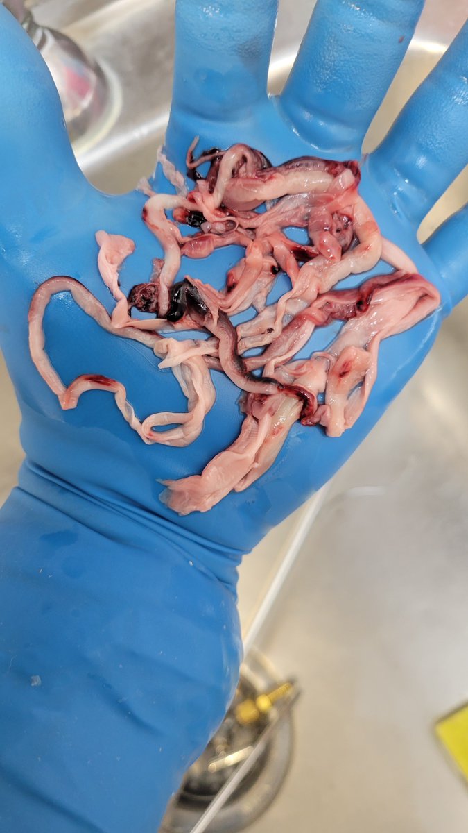 This is long, but it is covering some of the research on the fibrous clots. There's more to be done, but hopefully this may help others who are also doing research. 

rumble.com/v58sxv8-breaki…