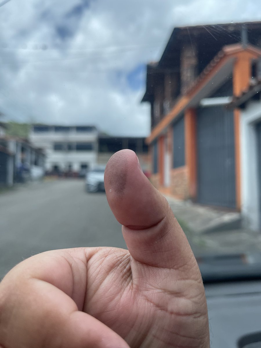 FreddyDCg's tweet photo. Y se logroooooo 🇻🇪 !! Después de 6 horas y 30 minutos de cola https://t.co/2g67Pi8d1L