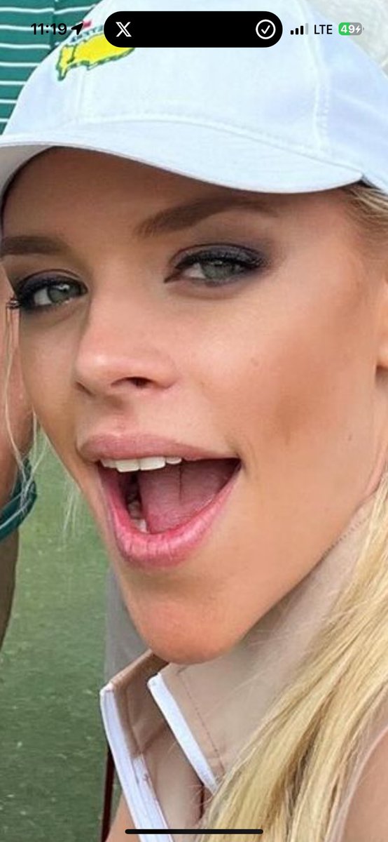 WordAlerts's tweet image. @JSB_TV another gold for the pointiest CHIN. #hutterite @Olympics