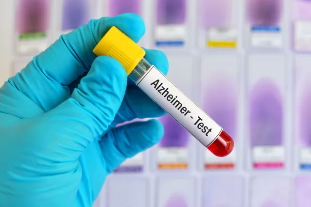 Unlikely_Buddha's tweet photo. The #Short-#Sightedness of #Limited #Insurance #Coverage for #Alzheimer's #Blood #Tests
Recent advancements in blood tests for Alzheimer's disease have the potential to revolutionize early diagnosis and treatment. https://t.co/RZmJFLWy8M