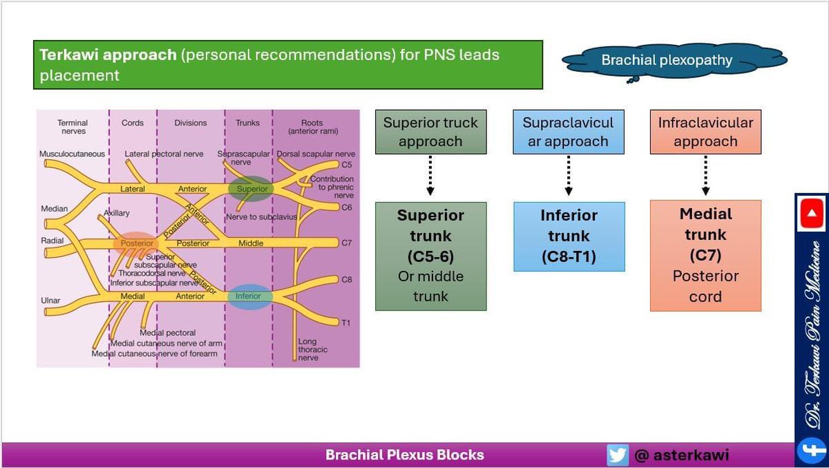 asterkawi's tweet image. Let us go above and beyond !

Brachial Plexus Blocks/Catheters/PNS: When? Where? How? Why?
youtu.be/sRJ32EqPDnQ

#Brachialplexus #InterscaleneBlock #SuperiorTrunkBlock #SupraclavicularBlock #InfraclavicularBlock #AxillaryBlock #regionalanesthesia