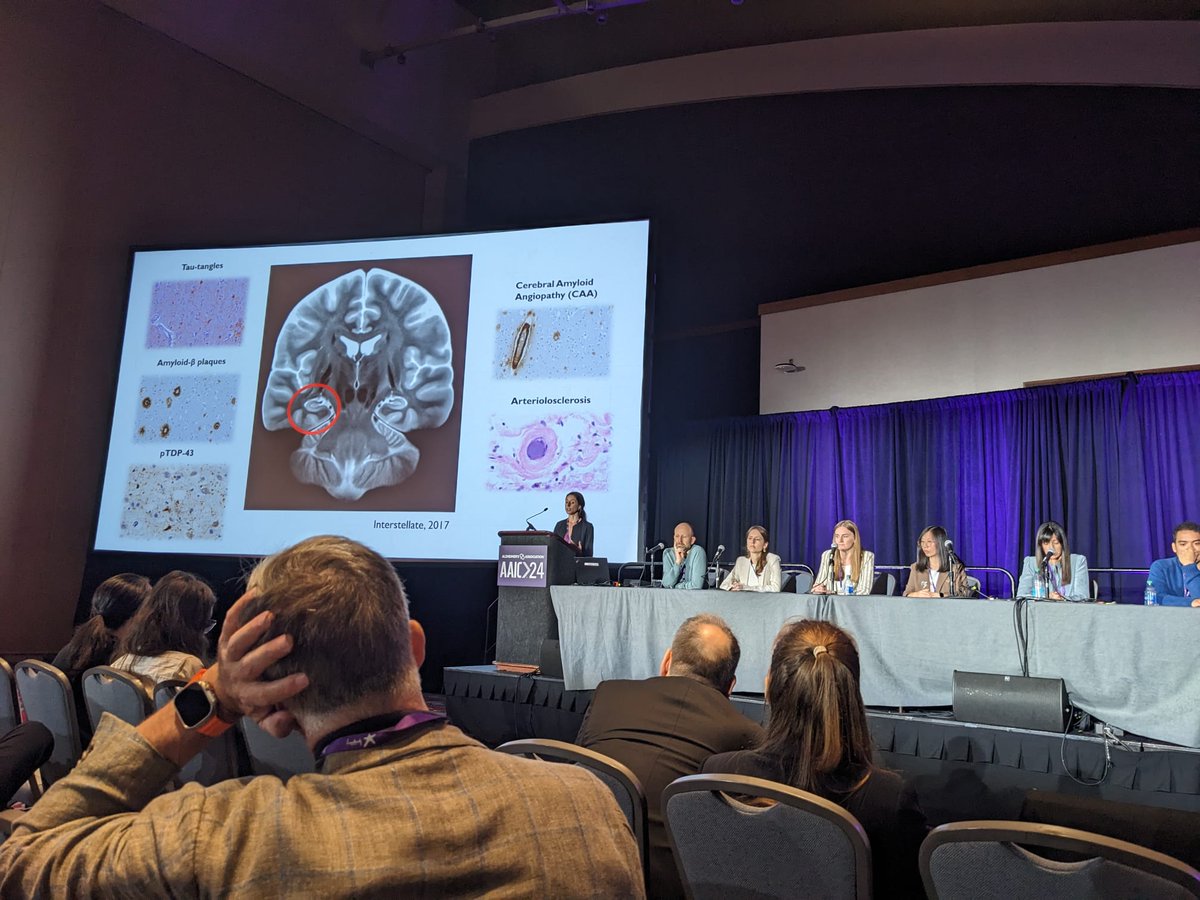 Valentina Perosa (@valentinaperosa) on Twitter photo #AAIC2024 in Philly already offered so much. Many new ideas, fun with colleagues, and the chance to talk about neuropathology at the Alzheimer's Imaging Consortium (AIC).🙏🧠 @SusanneVanVeluw <a href="/Francesco_Bax91/">Francesco Bax</a> #AAIC2024 in Philly already offered so much. Many new ideas, fun with colleagues, and the chance to talk about neuropathology at the Alzheimer's Imaging Consortium (AIC).🙏🧠 @SusanneVanVeluw <a href="/Francesco_Bax91/">Francesco Bax</a>
