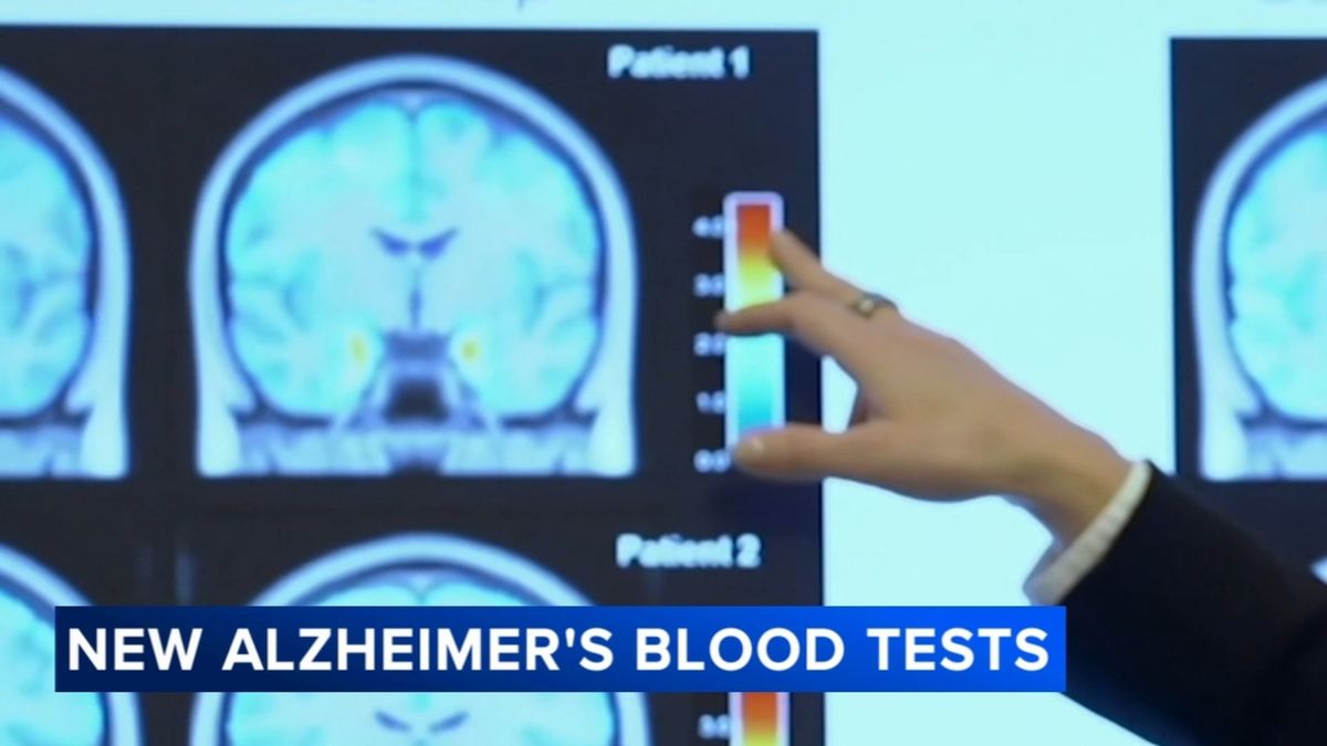 abc7newsbayarea's tweet image. Blood tests for Alzheimer's may be coming to your doctor's office. Here's what to know abc7ne.ws/3LJTPh2