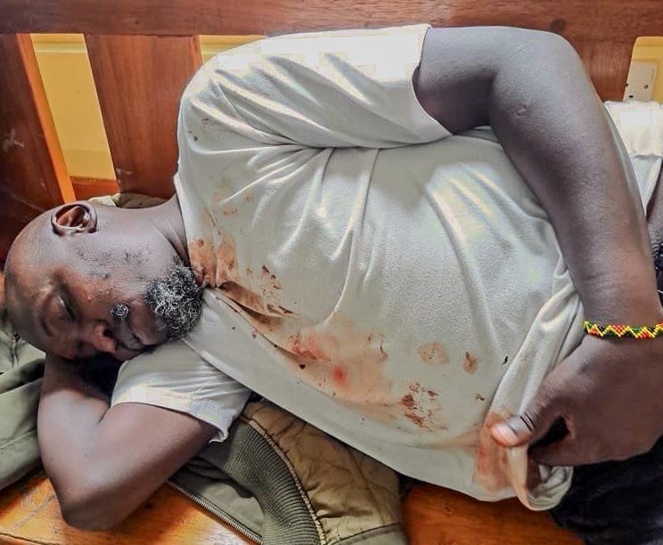 KHRC (@thekhrc) on Twitter photo #Statement
On July 23, police arrested human rights defender <a href="/OgutuBoniface/">Boniface Ogutu Akach</a> in Kisumu when he protested the bad governance that has crippled the country.
DCI officers tortured Ogutu, recording the abuse on their phones. They punched and strangled Ogutu, pierced his index finger, #Statement
On July 23, police arrested human rights defender <a href="/OgutuBoniface/">Boniface Ogutu Akach</a> in Kisumu when he protested the bad governance that has crippled the country.
DCI officers tortured Ogutu, recording the abuse on their phones. They punched and strangled Ogutu, pierced his index finger,