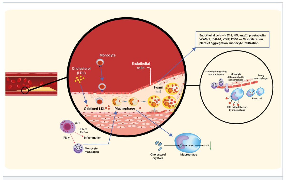 EuroIntervention (@eurointerventio) on Twitter photo Targeting inflammation in atherosclerosis: overview, strategy and directions
This review by @ron_wasman, <a href="/ItaloPorto2/">Italo Porto</a> et al. explores inflammation mechanisms in atherosclerosis, potential biomarkers, therapeutic options and future advancements. #eapci ow.ly/b0RG50SLOak Targeting inflammation in atherosclerosis: overview, strategy and directions
This review by @ron_wasman, <a href="/ItaloPorto2/">Italo Porto</a> et al. explores inflammation mechanisms in atherosclerosis, potential biomarkers, therapeutic options and future advancements. #eapci ow.ly/b0RG50SLOak