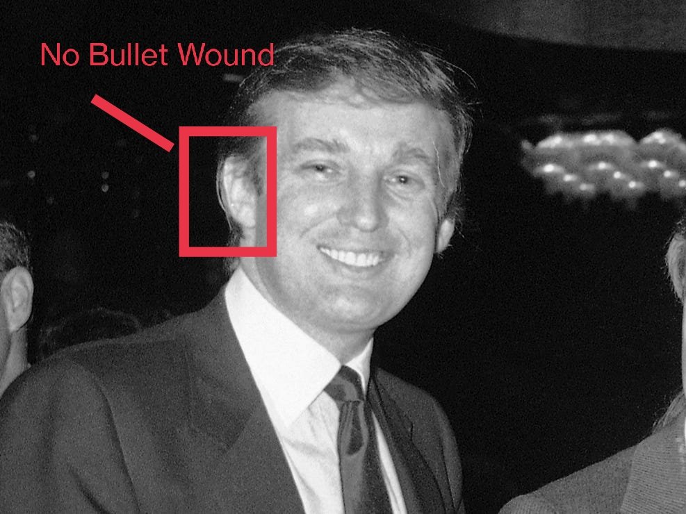 RedSC10's tweet image. Democrats are like: "See! There is no bullet wound"