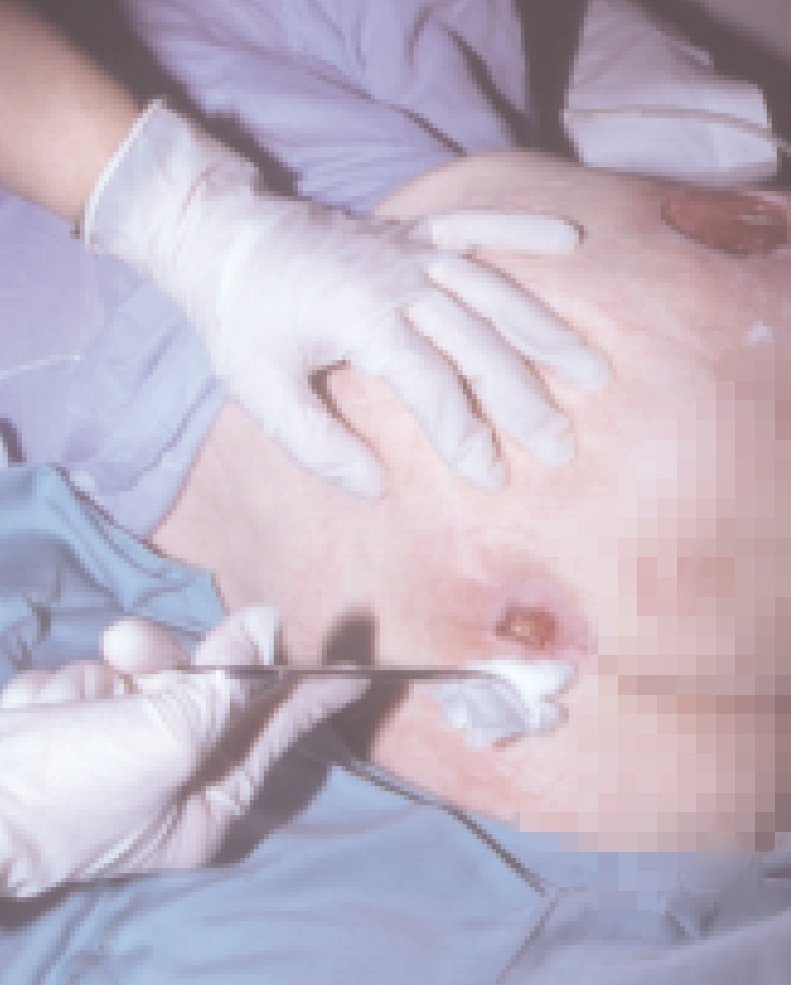 anlu_lu's tweet photo. ¿Sabías que?. Las #úlceras por presión pueden afectar a personas #inmovilizadas con un daño al tejido con dolor, enrojecimiento y más molestias relacionadas . https://t.co/7mkgeiJYF2
