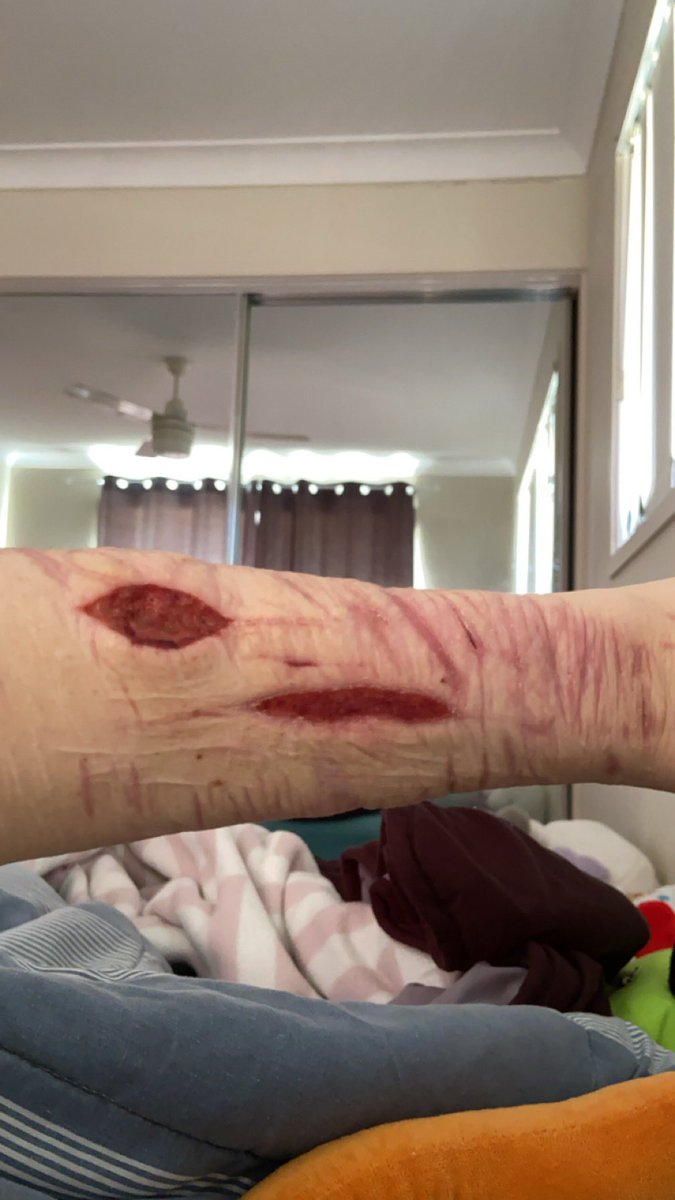 ruis_left_arm's tweet photo. tw healing sh
will these heal for the 31st of august ... i need them to be healed 👿 https://t.co/g91UMyCW42