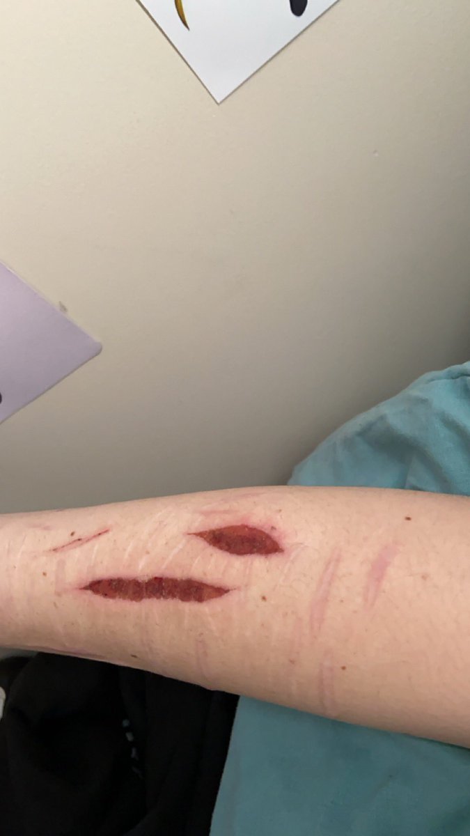 ruis_left_arm's tweet photo. tw healing sh
will these heal for the 31st of august ... i need them to be healed 👿 https://t.co/g91UMyCW42
