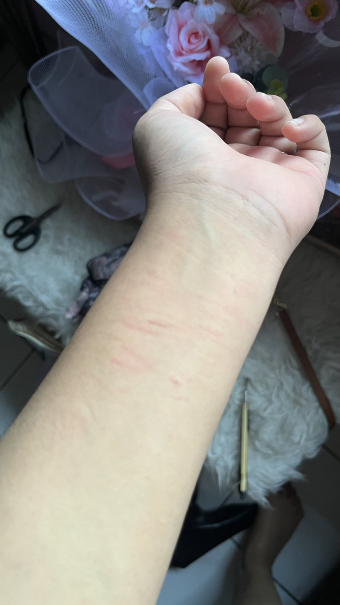 sweathearrtt's tweet photo. Jak, ko ada orang yg tega biarin gue terluka ya? Dulu gue sangat mengkhawatirkan hal ini sm oranglain tapi skrg gue sendiri yg ngalamin sakit nya😭😭 gue pantas dapetin ini ya? Gue sedih bgt cape bgt nyerah bgt posisi gue selalu salah gapernah bener dimatanya https://t.co/L19sLAb6bj