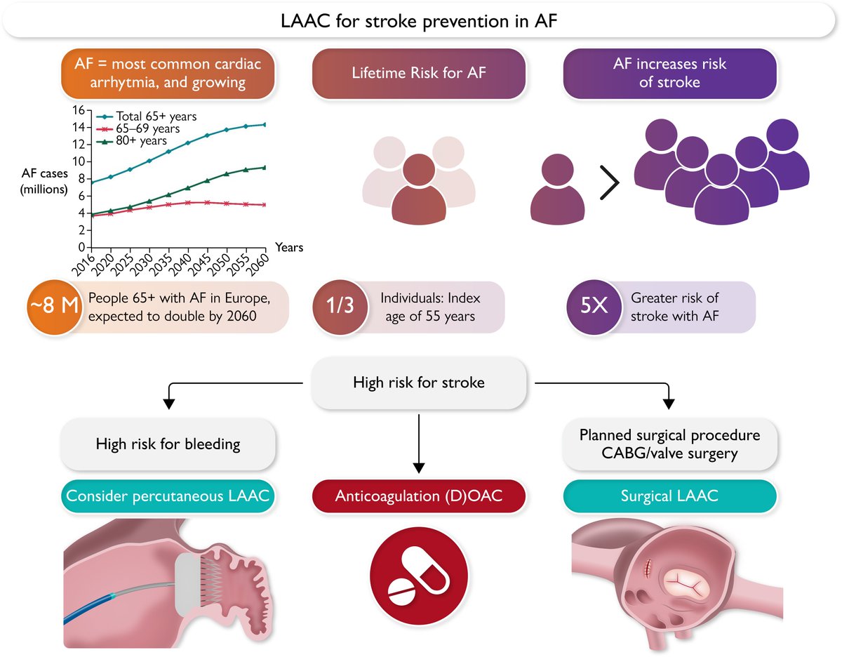 Left atrial appendage closure for stroke prevention in atrial fibrillation: current status and perspectives. A State-of-the-Art Review in #EHJ 👉 bit.ly/3A8FGXO

#atrialfibrillation #afib <a href="/RoccoMontone/">Rocco Montone</a> <a href="/ehj_ed/">EHJ Editor-in-Chief</a>