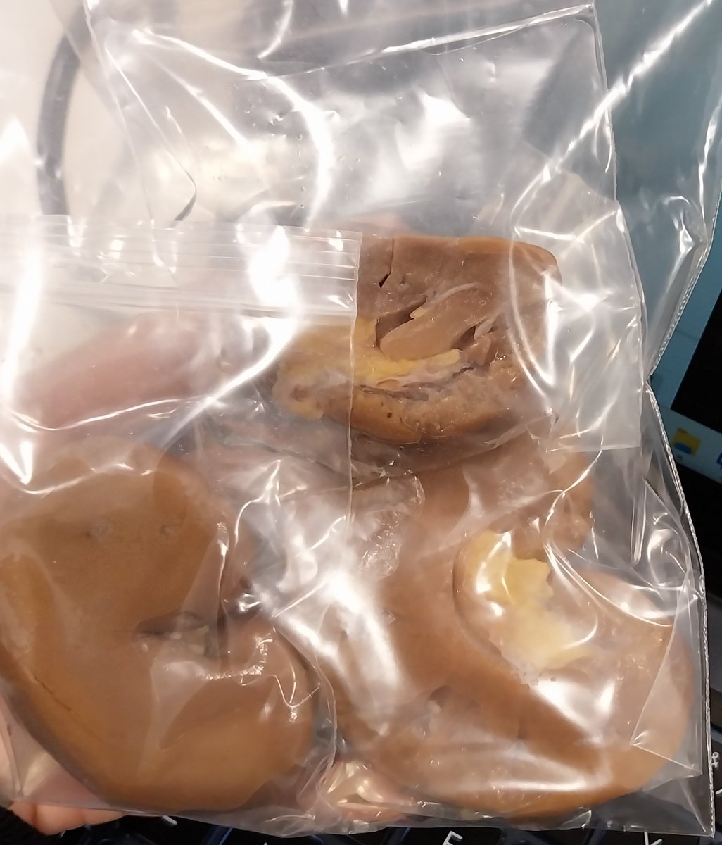 dilutedhcl's tweet photo. kidneys 🫘 https://t.co/uEoGK2dLmZ