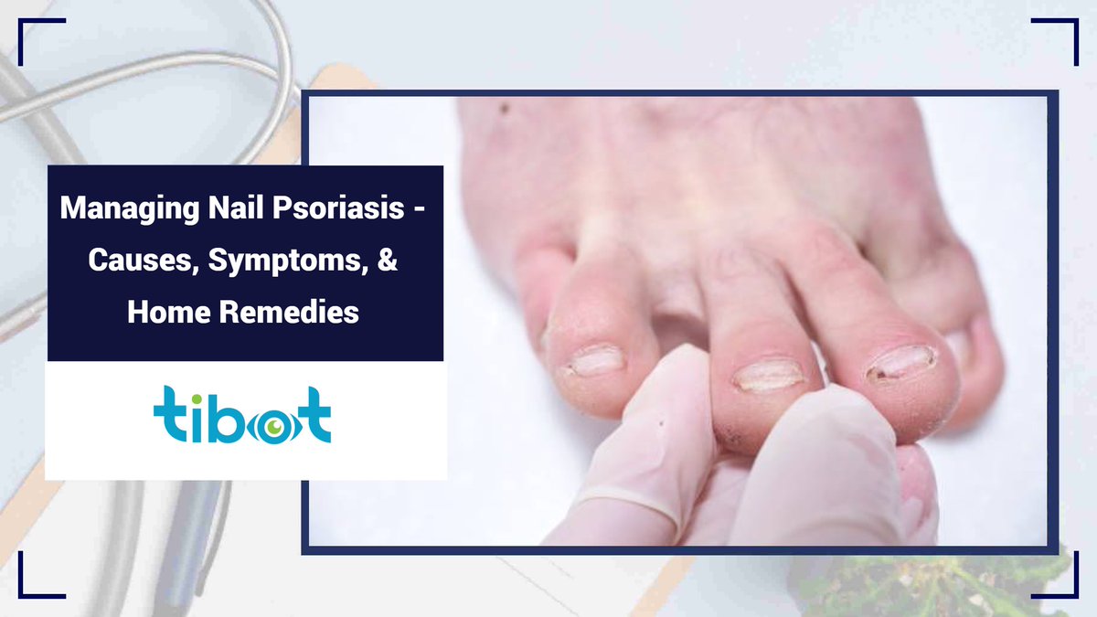 tibot_ai's tweet photo. Nail psoriasis can be challenging, but you're not alone. Learn about the causes, symptoms, &amp; home remedies that can make a difference. Empower yourself with knowledge. 🌼👩‍⚕️
Learn More: https://t.co/264MaPKHNL

#NailPsoriasis #HealthJourney #PsoriasisCare #NailTreatment #SelfCare https://t.co/66jsyZvOAD