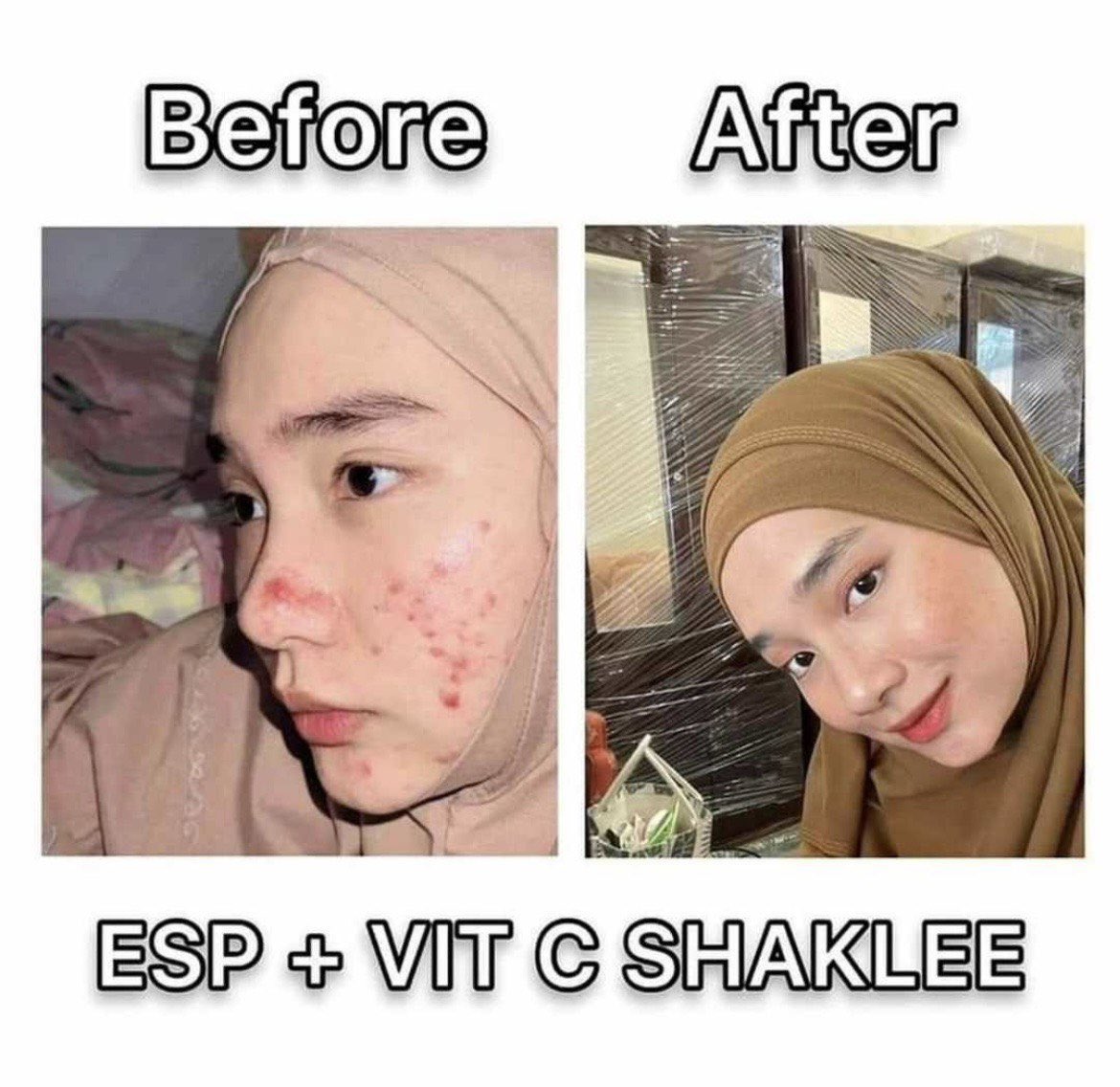 SEKARANG TENGAH ADA PROMO ‼️

Buy 2 free 1 😱

Memang jimat sangat la! 

✅elok untuk skin
✅beri tenaga
✅sesuai untuk ibu hamil/menyusu/pantang
✅milkbooster 

wasap.my/60145314641/Pr…

<a href="/RTNiaga/">RTNiaga Anda</a> <a href="/JualBeliKuantan/">JualBeliKuantan</a> <a href="/KuantanInfo/">🇲🇾info.kuantan🇲🇾</a> <a href="/KuantanOnline/">Kuantan Online</a> <a href="/KuantanTV/">Kuantan Pahang</a>