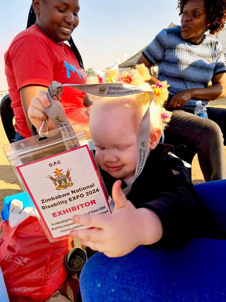IanTaku (@vambeian1) on Twitter photo I use my family to amplify disability advocacy..Lived experiences are impactful. Wadiwa’s skin (our daughter) was topical during the Disability Expo in Bindura. She became the expo herself….<a href="/MKundi21/">MKundi Foundation</a> <a href="/Sightsavers/">Sightsavers</a> <a href="/anashemurombezi/">Anashe Murombedzi</a> <a href="/DeafZimTrust/">Deaf Zimbabwe Trust</a> I use my family to amplify disability advocacy..Lived experiences are impactful. Wadiwa’s skin (our daughter) was topical during the Disability Expo in Bindura. She became the expo herself….<a href="/MKundi21/">MKundi Foundation</a> <a href="/Sightsavers/">Sightsavers</a> <a href="/anashemurombezi/">Anashe Murombedzi</a> <a href="/DeafZimTrust/">Deaf Zimbabwe Trust</a>