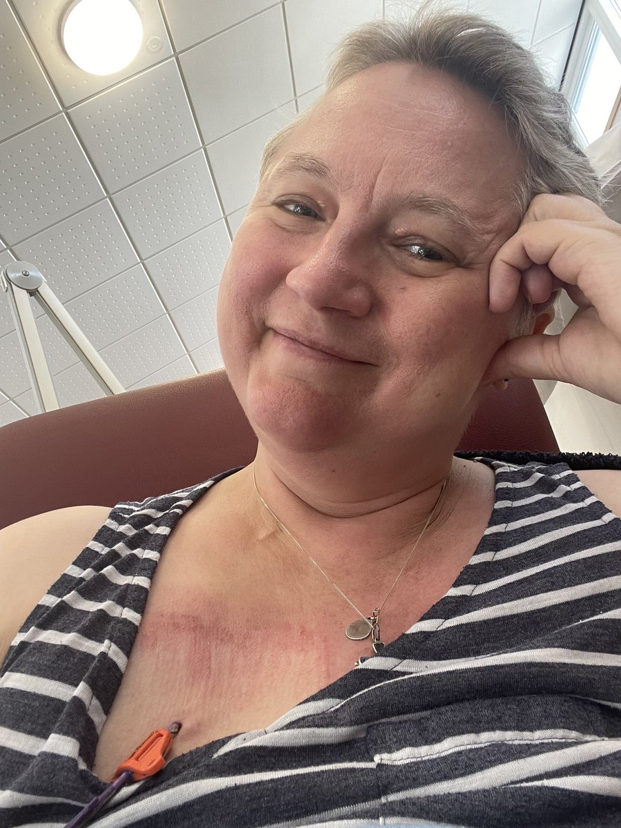 annemariekramer's tweet photo. Here goes #cycle5 of #14 @LandDHospital As always v grateful for outstanding care from the nurses &amp; volunteers &amp; great chat w/ fellow patients. Over 1/3 of the way through! TY you so much for your prayers and good wishes ❤️ #chemo #krokpokroku #bilateralbreastcancer #breastcancer https://t.co/zEtFLaYFvo