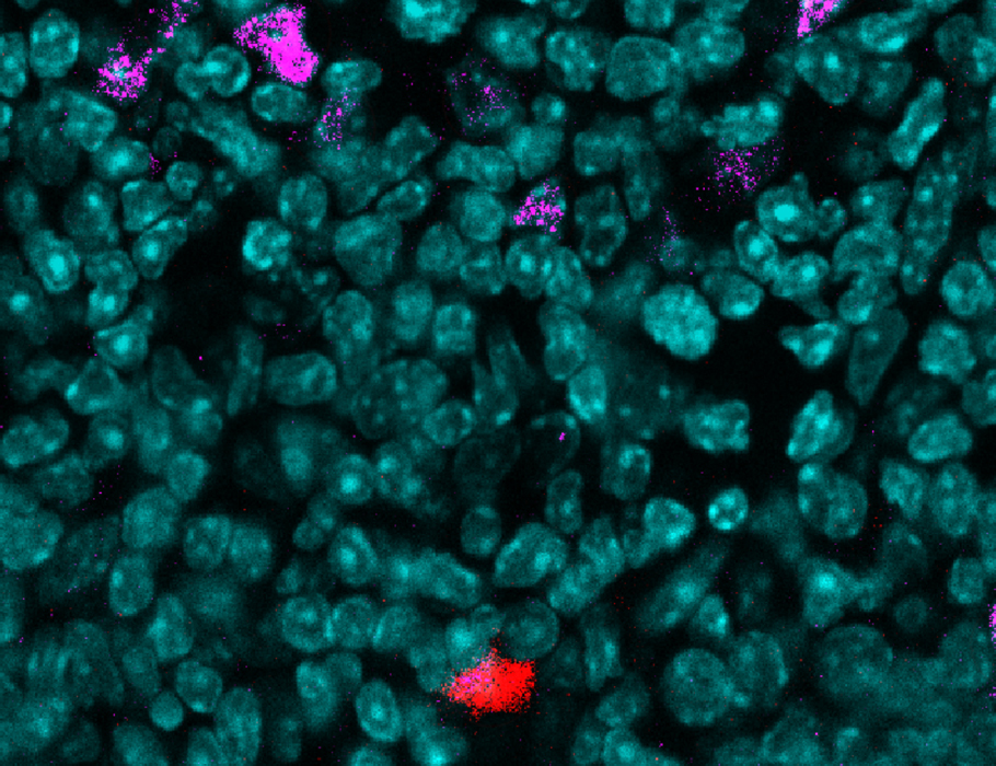 Baseline levels of type I and III #IFNs in the #thymus promote diverse #Tcell receptor repertoire and self-tolerance in mice. 

Read more in Science #Immunology: scim.ag/7PO