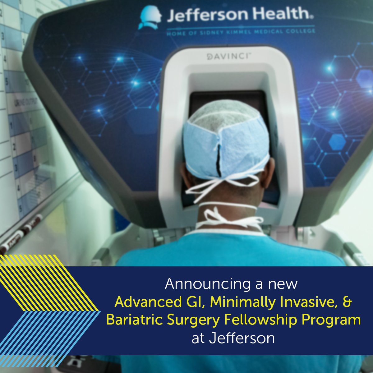 Jefferson Surgery (@jeffsurgery) on Twitter photo We are proud to announce a new Advanced GI, Minimally Invasive & Bariatric Surgery Fellowship at <a href="/TJUHospital/">Jefferson Health</a> approved by <a href="/FellowshpCouncl/">Fellowship Council</a>
This 1-year clinical fellowship focuses on minimally invasive techniques for surgical management of complex GI, foregut, bariatric, & hernia We are proud to announce a new Advanced GI, Minimally Invasive & Bariatric Surgery Fellowship at <a href="/TJUHospital/">Jefferson Health</a> approved by <a href="/FellowshpCouncl/">Fellowship Council</a>
This 1-year clinical fellowship focuses on minimally invasive techniques for surgical management of complex GI, foregut, bariatric, & hernia