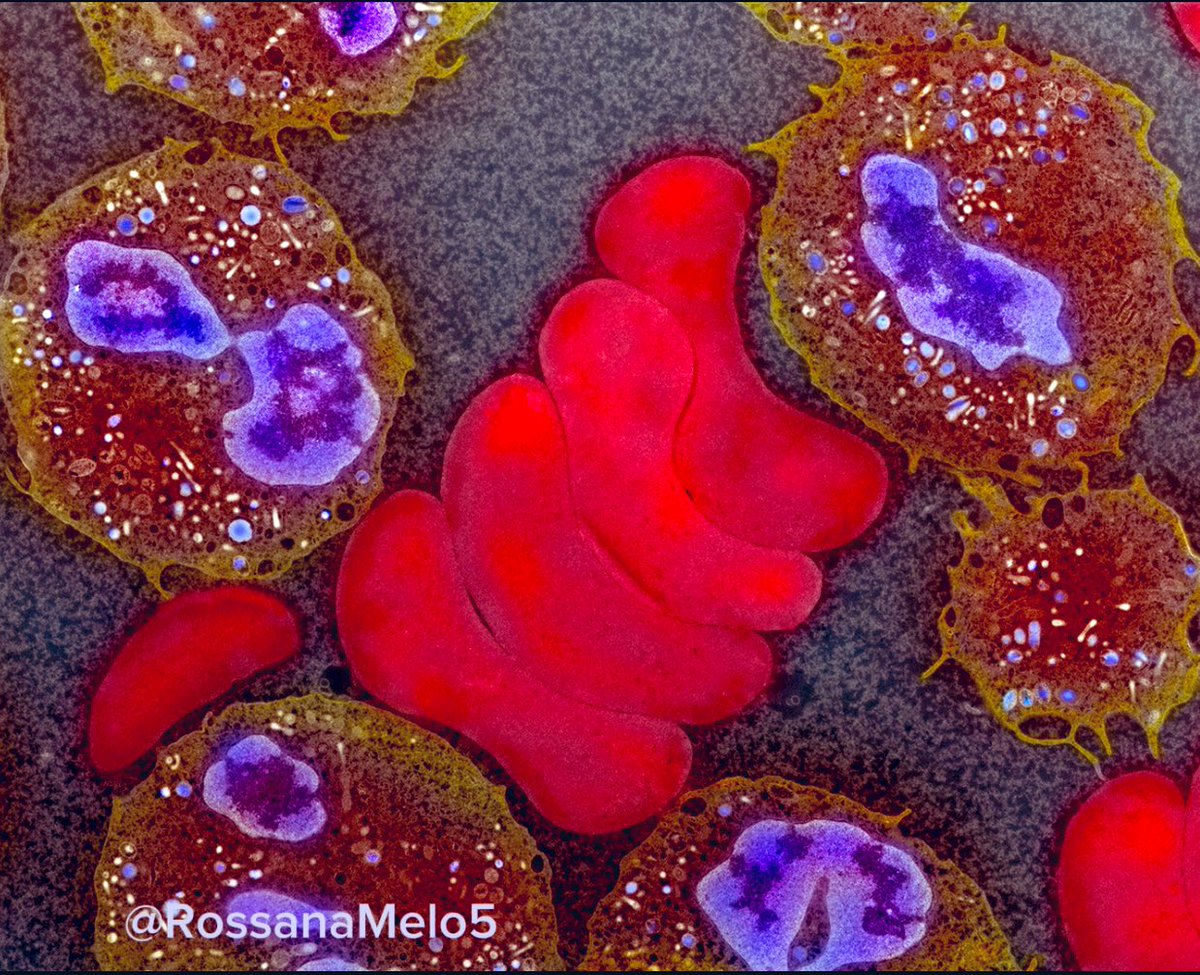 RossanaMelo5's tweet photo. This vibrant #MicroscopyMonday features #neutrophils seen in the human blood at high resolution! #EMmonday #microscopy #sciart https://t.co/CdMWeOaVvt